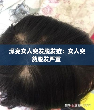 漂亮女人突发脱发症：女人突然脱发严重 