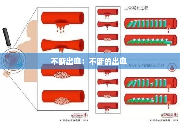 不断出血：不断的出血 